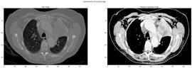 fig1