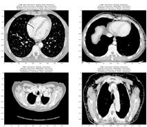 fig2