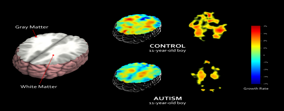 /word/media/image1.png
