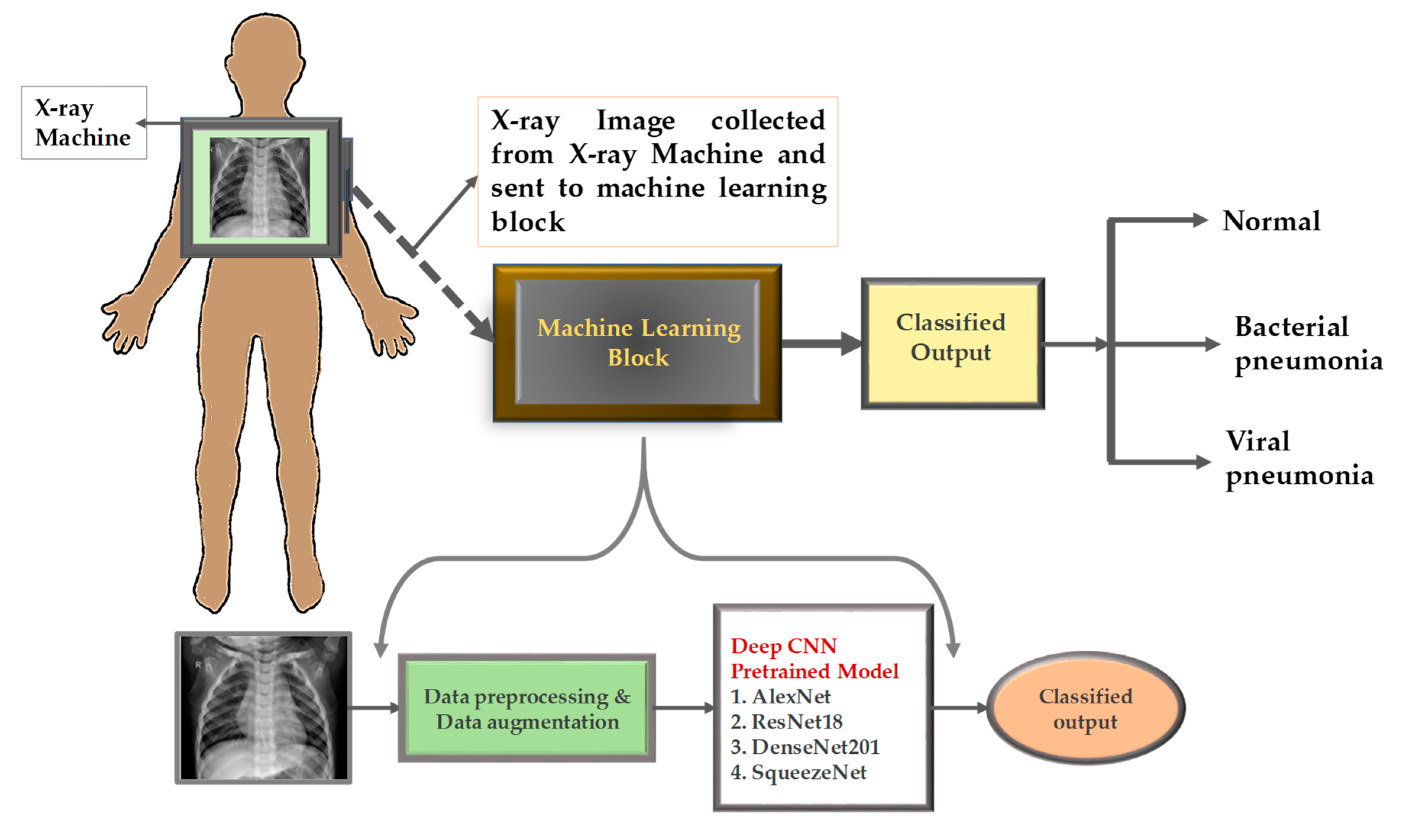 Figure 1. CNN-Based Medical Image Classification Pipeline(Source:https://pub.mdpi-res.com/applsci/applsci-10-03233/article_deploy/html/images/applsci-10-03233-g008.png?1590214485)