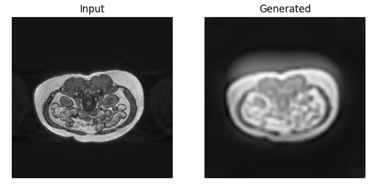 Figure 3. Example generated by U-Net