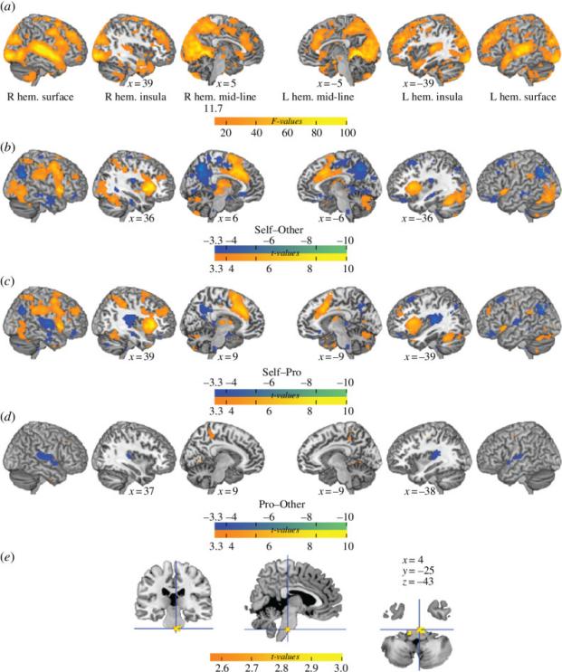 Figure 2. Depicts the main effects associated with observing an individual singing. Panels b to d present the results of t-tests contrasting brain activity elicited by viewing different singers. In the maps, warm colors represent positive values, whereas blue shades indicate negative values.