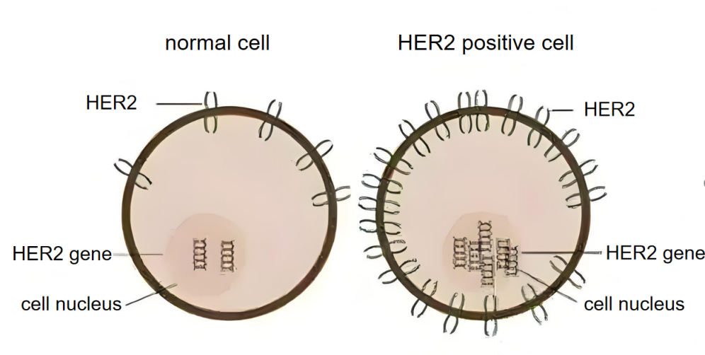 Figure 2. Comparison between the normal cell and HER2 positive cell
