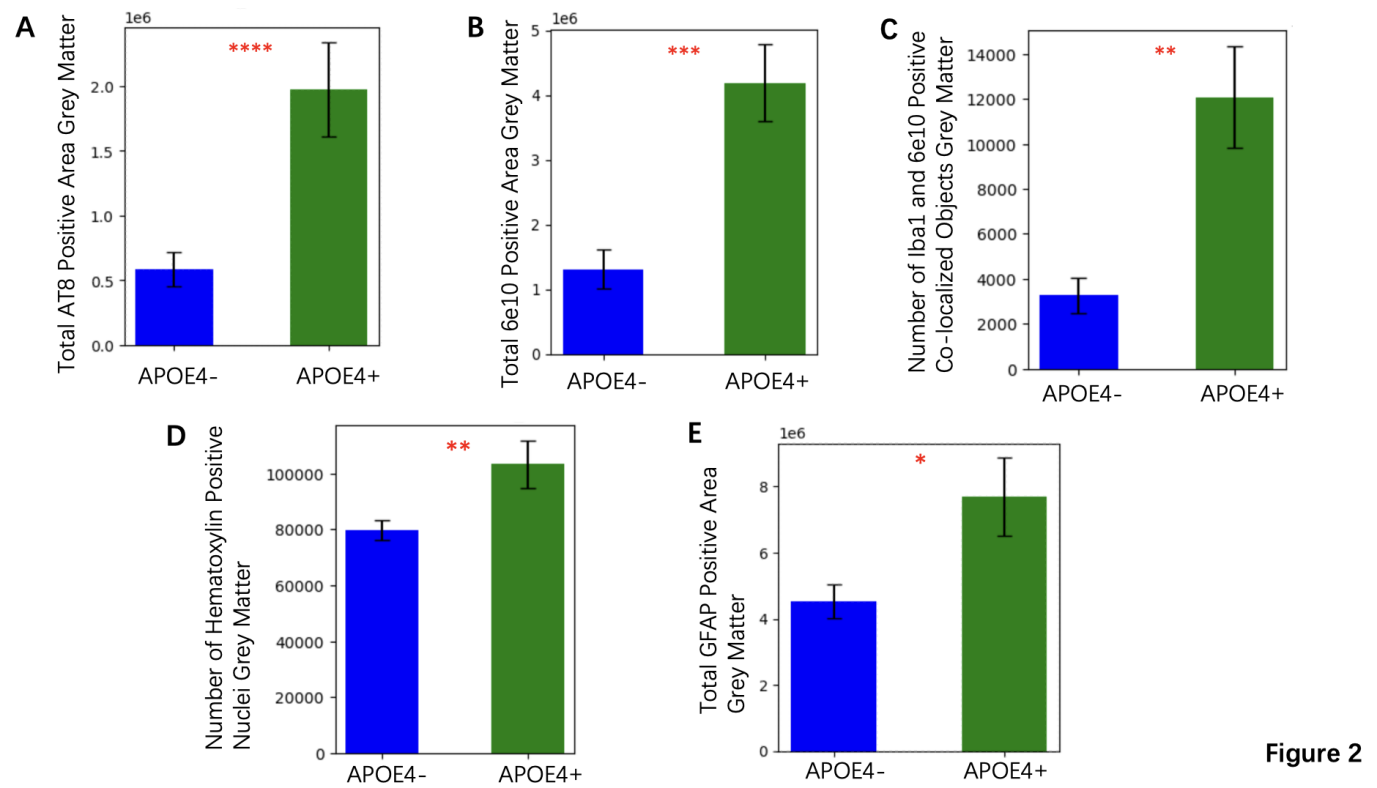 Figure 2. Comparison of Key Pathological Parameters Between APOE4+ and APOE4- Groups (A) Total AT8 Positive Area in Grey Matter Bar graph comparing the mean total AT8 positive area in grey matter between APOE4+ and APOE4- groups. Error bars represent the standard error of the mean (SEM). Showed statistically significant increase in the APOE4+ group (p < 0.0001) (B) Total 6e10 Positive Area in Grey Matter Bar graph showing the mean total 6e10 positive area in grey matter for APOE4+ and APOE4- groups. Error bars represent SEM (p < 0.001) (C) Number of Iba1 and 6e10 Co-localized Objects in Grey Matter Bar graph illustrating the mean number of Iba1 and 6e10 co-localized objects in grey matter for APOE4+ and APOE4- groups. Error bars represent SEM. The APOE4+ group shows a statistically significant increase (p < 0.01) (D) Number of Hematoxylin-Positive Nuclei in Grey Matter Bar graph depicting the mean number of hematoxylin-positive nuclei in grey matter for APOE4+ and APOE4- groups. Error bars represent SEM. Showed a significant increase in the APOE4+ group (p < 0.01) (E) Total GFAP Positive Area in Grey Matter Bar graph comparing the mean total GFAP positive area in grey matter between APOE4+ and APOE4- groups. Error bars represent SEM. The APOE4+ group exhibits a significant increase (p < 0.05)