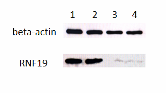 Figure 3. Expression of RNF19A through Western Blot