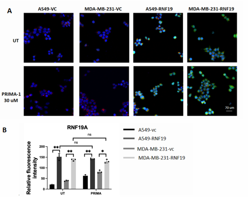 Figure 4. The Subcellular localization of RNF19A by TP53 activator